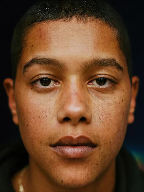 Гладкая кожа без изъянов и густые здоровые волосы - до и после